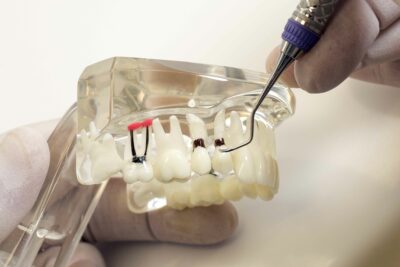 Cirug A Periodontal Cl Nica Dental Goenea